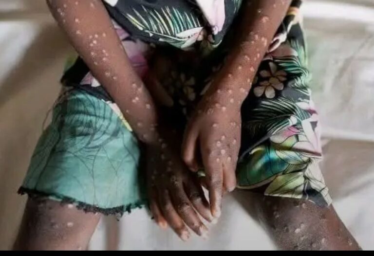 #የጥንቃቄ_መልዕክት!