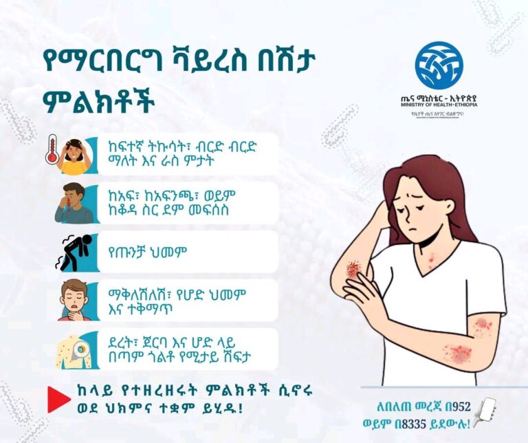 የማርበርግ ቫይረስ በሽታ ምልክቶች